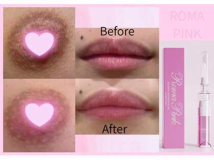 美成(vise)の写真