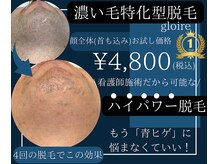 グロワール(gloire)