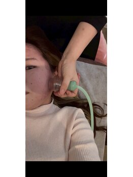 フェリーチェ(felice)/小顔に 10分3300円のセルクラ