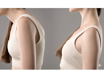 リスタ(Re:STA)の写真/【辛い肩こりを根本改善!!】繰り返す肩凝り・首こりは姿勢がい原因!整えて慢性的な辛さに終止符を!