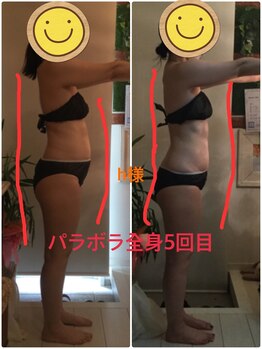 リラクゼーションエステハウス リンレイ(RINREI)/パラボラ全身モニターコース