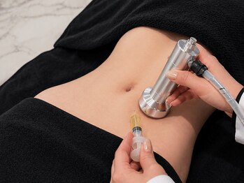 ツキ(TUKI+)の写真/【脂肪燃焼】全身ではなく、気になる場所だけ。お腹・二の腕・太もも・腰まわりへ1回60分で集中