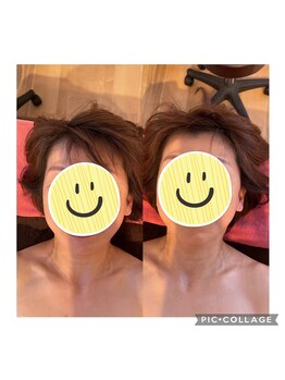クラルスシンメトリーサロン 高槻店(Clarus Symmetry Salon)/左施術前、右施術後♪
