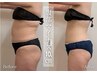 【夏までに痩せたい方】痩身マシン/脂肪冷却の2回体験 13,200円