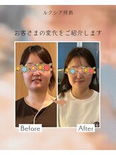 ルクシア(Luxia)/小顔