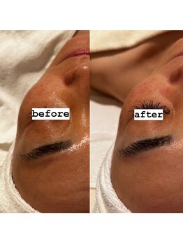 ポーラ 大阪十三店(POLA)/一度での変化。くすみ改善