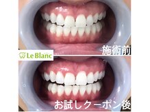 ルブラン 奈良店(Le Blanc)/身だしなみの大事な1つ！！