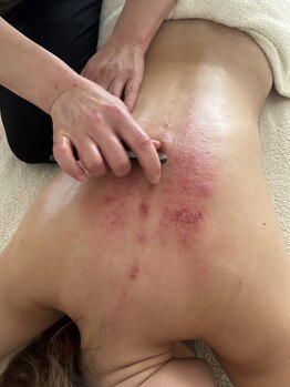 りふの写真/【ただの癒しじゃない!翌朝のスッキリ感に驚く☆】グアサーで体の芯から眠れる体へ…睡眠の質が上がる!