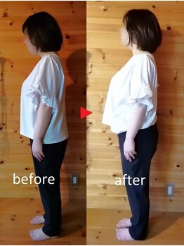 メリッサ接骨 整体院/美姿勢、お任せください!