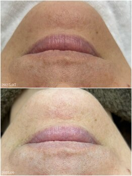 ヒルナム(Heal Nam)/プロセルセラピーズ~フェイス~