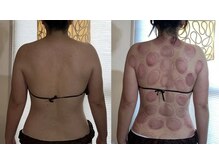 ウラヤス 恵比寿(Urayasu)/月一来店4回目，50代