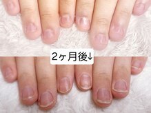 グレースレディ 大阪店/深爪/自爪育成/フィルイン