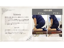 グロース鍼灸整骨院 豊浜院/