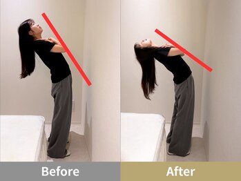 せなかのはね 井尻店/20代　猫背　肩こり　腰痛