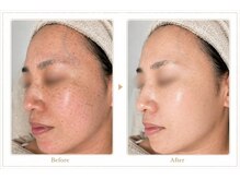 ロイヤル(ROYAL)の雰囲気（トロイアルケで年齢肌改善◎口コミ多数♪）