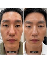 ラフルール(LA FLEUR)/Before & After 