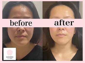 サクラ(SAKURA)/エアバリ効果