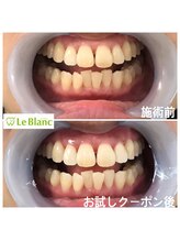 ルブラン 奈良店(Le Blanc)/口コミから広がる