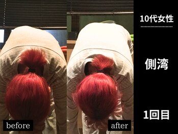 ミーツ(MEETS)/側湾/肩こり