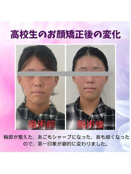 ハナノ整体院/姿勢も顔も整えました