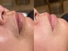 【圧倒的美白！！】CSPクリアスキンプログラム　最新美白フェイスWax1回