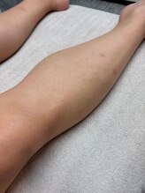 ミセレルオカザキ(MISEREL OKAZAKI)/l