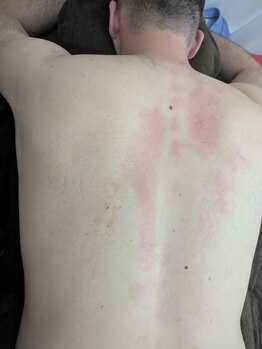 リデザイン 京都(REDESIGN)/REDESIGN京都中医施術法