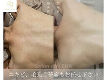 サロン ド レナ(Salon de LENA)/ハーブピーリング サロンドレナ