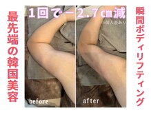 リリー(LILY)/韓国で大人気！