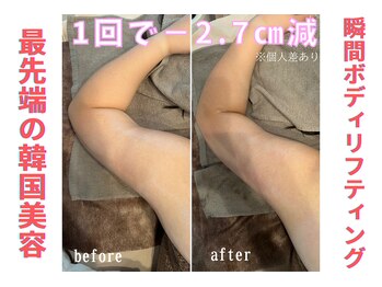 リリー(LILY)/韓国で大人気!