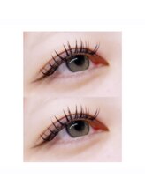 ブライズ(BRISE)/バインドロック