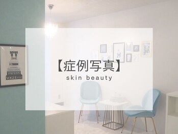 小顔専門店Lift(リフト)下北沢/小顔専門店Lift|Before After