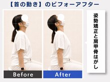 大阪心斎橋整体院/整体で首の痛み改善♪