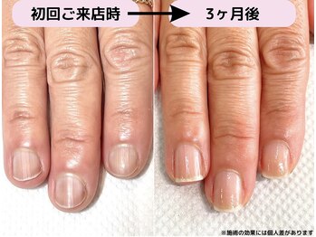 カピリナ(Ka Pilina)/最強のネイルケア