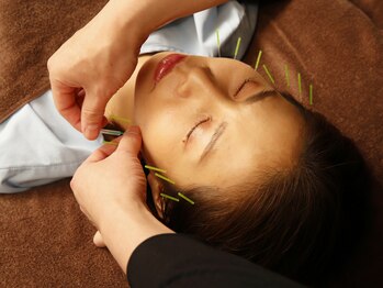 ピアース(Pierce)/美容とはりの技術を融合した手技