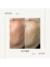 ワイドット(Y.)/肌色の変化