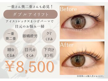 ミーカラー(me calla)の写真/口コミ高評価★目元悩みの救世主【ダブルアイリフト】一重/奥二重/まぶたの下がりが気になる方必見◎