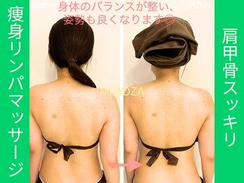 ミモザ鍼サロン(mimoza鍼サロン)/猫背も解消！！