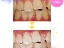 エクシアホワイト 宮崎末広店/