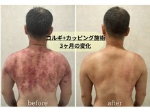 アグレーブル(Agreable)/頭痛や眼精疲労、慢性こり解消