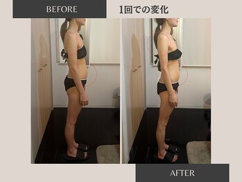 リラ(Rela)/before・ after