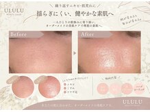 ウルル 金山駅前店(ULULU)の雰囲気（【メイクルームあり◎】全エステプラン、当日からメイクOK☆）