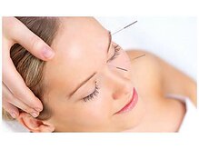 リアンドハリ(Rien’d Hari)/究極のエイジングケア美容鍼