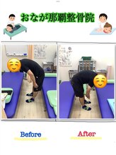 おなが浦添当山整体院/腰痛、可動域改善！
