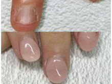 グレースレディ/つめが生え変わるには半年…