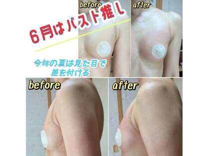 スノードロップ(snowdrop)の写真