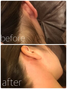 ニコプラス(NICO+)/