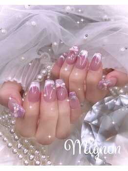 ミニョン 新宿(Mignon)/定額ネイル♪