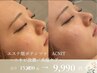 【エステ版ポテンツァ】ニキビケア★スキンジェクション：ACNIT￥9,990