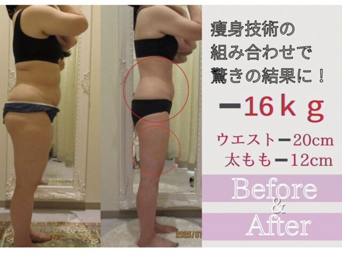 イーズスリミングプロ 横浜コレットマーレ店｜ホットペッパービューティー